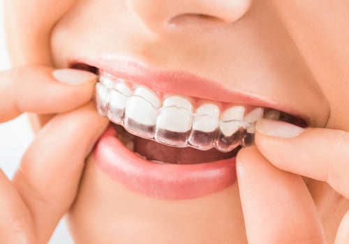 Do retainers get paid back?